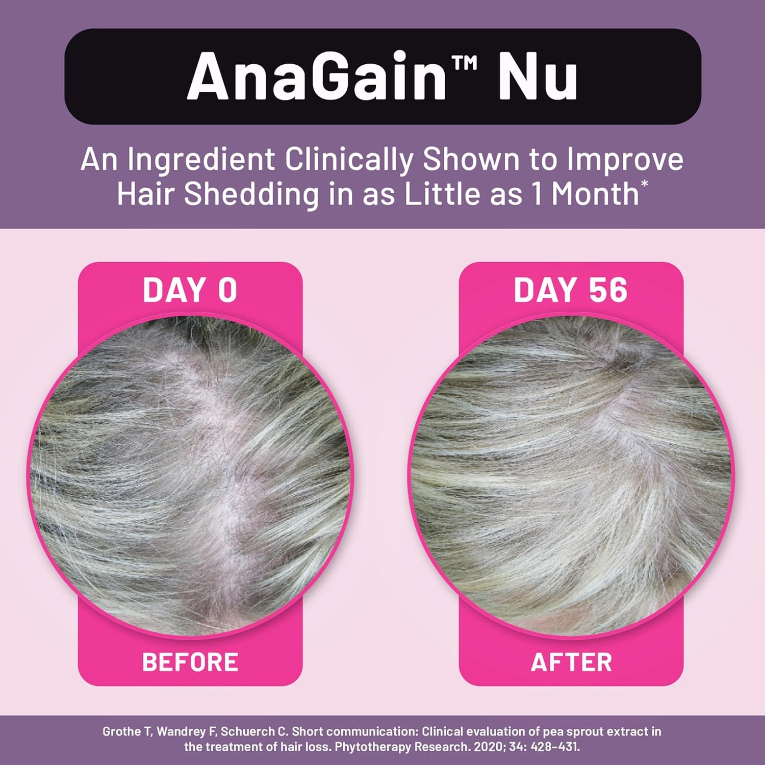 image:imageNatureWise Hair Growth Plus Hair Growth Supplements Women amp Men With Clinically Tested AnaGain Nu No Biotin Sugar Free amp Vegan Pistachio Caramel Flavor 15 Fl Oz 30 Day Supply